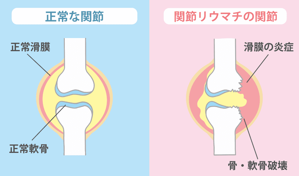 発症する年齢