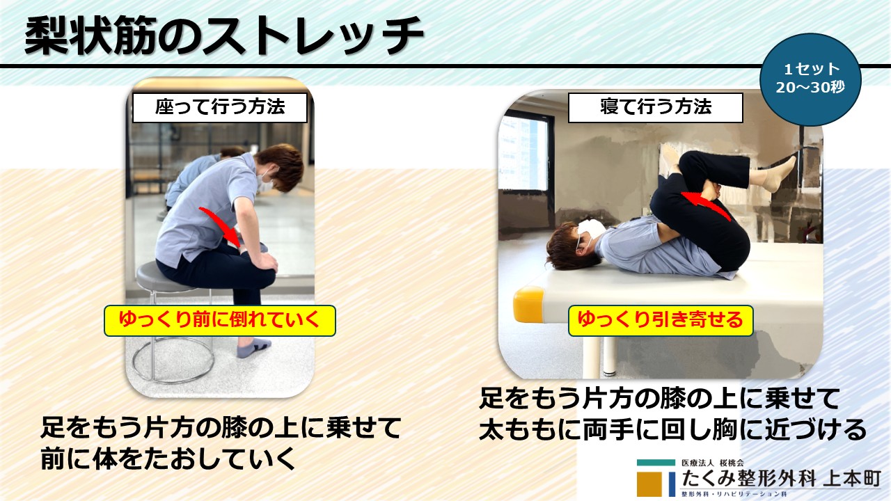 梨状筋ストレッチ